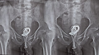 ఏమో గుర్రానికి రెక్కలొచ్చే.! ప్రైవేట్ పార్టులో నొప్పితో ఆస్పత్రికి.. డాక్టర్లు టెస్టులు చేయగా