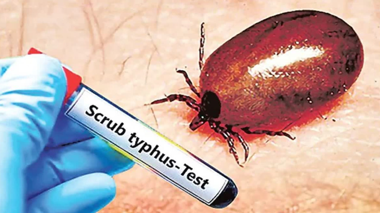 Scrub Typhus: ఏపీలో దడ పుట్టిస్తున్న కీటకం.. ఇద్దరు మృతి.. లక్షణాలు ఇవే..!