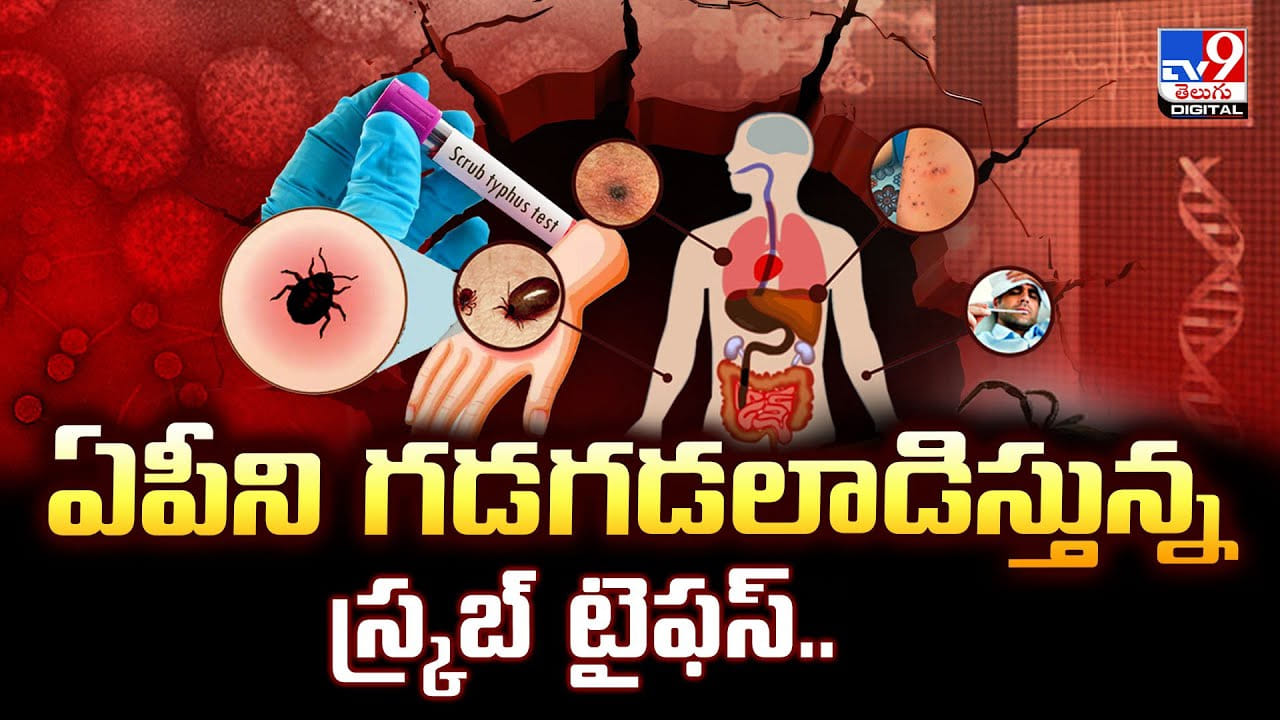 Andhra Pradesh: ఏపీని గడగడలాడిస్తున్న స్క్రబ్ టైఫస్
