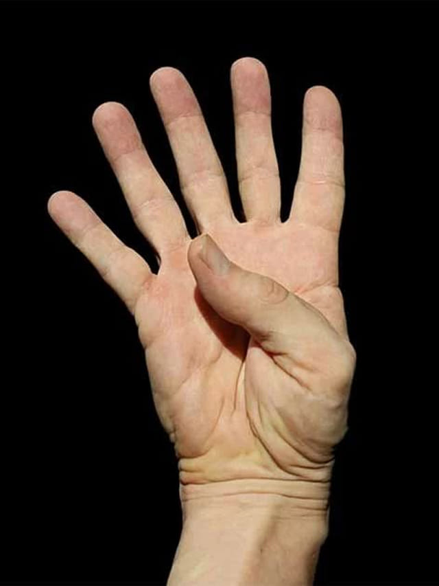 చేతికి ఆరు వేళ్లు ఉంటే అదృష్టమా.? పండితుల మాటేంటి.?