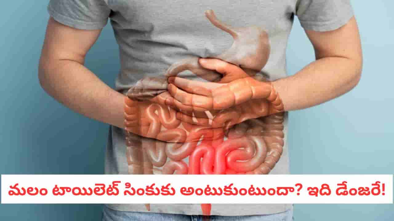 Gut Health: మలం రంగు మారిందా?.. ఈ 5 వ్యాధులు నిద్రలేచినట్టే!