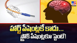 హార్ట్ పేషెంట్లకే కాదు… స్ట్రోక్ పేషెంట్లకూ ‘స్టెంట్’!