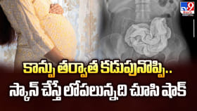 కాన్పు తర్వాత కడుపునొప్పి.. స్కాన్ చేస్తే లోపలున్నది చూసి షాక్‌