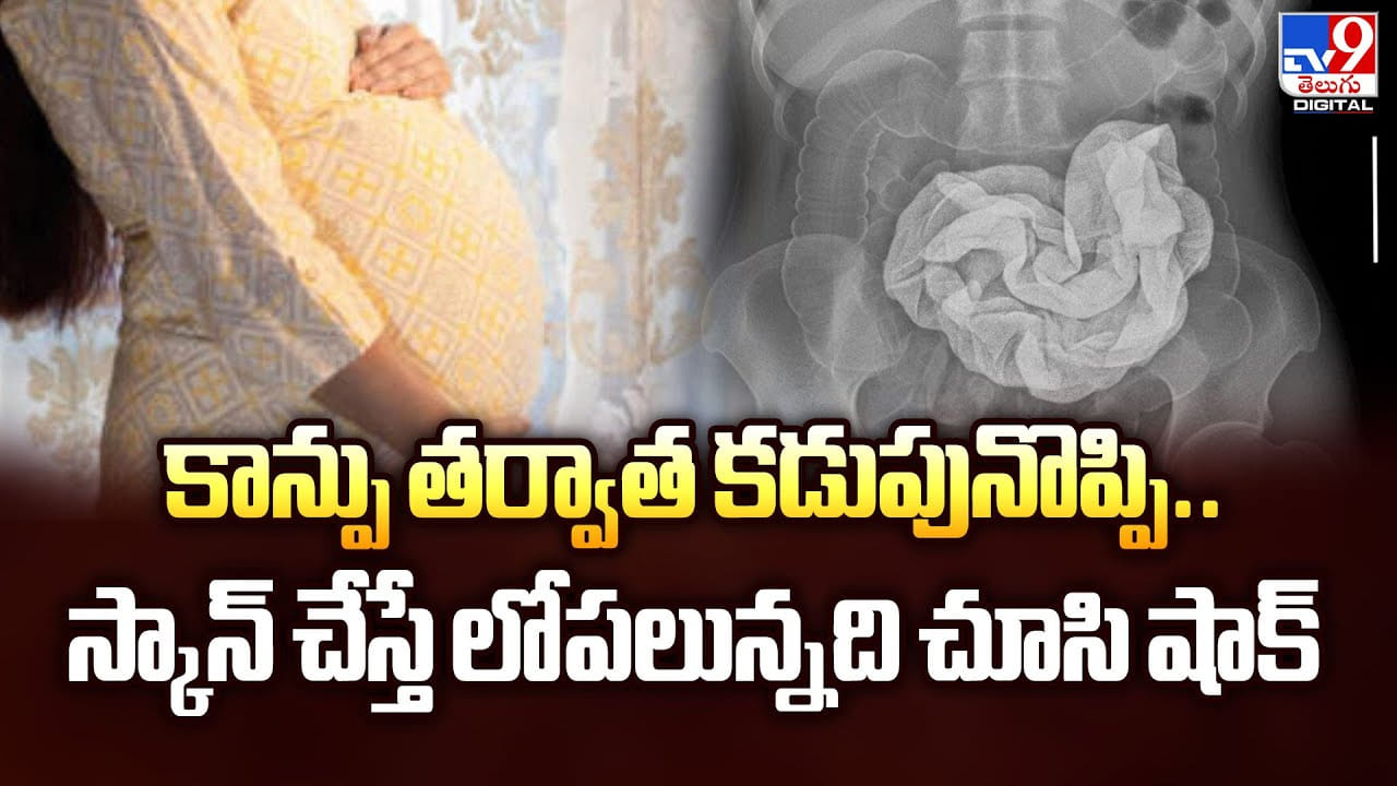 కాన్పు తర్వాత కడుపునొప్పి.. స్కాన్ చేస్తే లోపలున్నది చూసి షాక్ వీడియో కాన్పు తర్వాత కడుపునొప్పి.. స్కాన్ చేస్తే లోపలున్నది చూసి షాక్ వీడియో