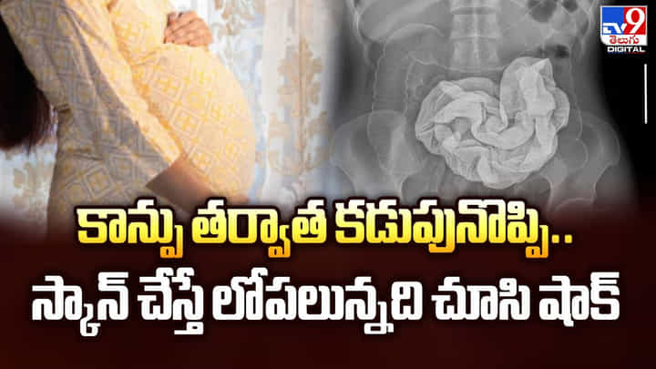 కాన్పు తర్వాత కడుపునొప్పి.. స్కాన్ చేస్తే లోపలున్నది చూసి షాక్ వీడియో కాన్పు తర్వాత కడుపునొప్పి.. స్కాన్ చేస్తే లోపలున్నది చూసి షాక్ వీడియో