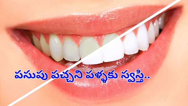 మీ దంతాలు తెల్లటి ముత్యాల్లా మెరవాలంటే..ఈ మూడు పదార్థాలు ఉంటే చాలు..