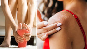 మనం చేసే ఈ తప్పులతోనే యూరిక్ యాసిడ్ గుట్టలా పెరుగుతుందట..