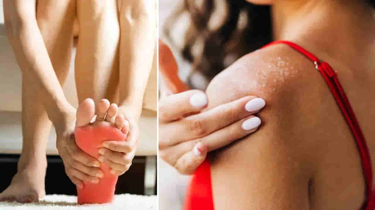 మనం చేసే ఈ తప్పులతోనే యూరిక్ యాసిడ్ గుట్టలా పెరుగుతుందట.. ఇలా చేస్తే దెబ్బకు నార్మల్..