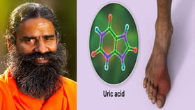 యూరిక్ యాసిడ్ సమస్యతో బాధపడుతున్నారా..? ఇలా చేస్తే వెంటనే ఉపశమనం