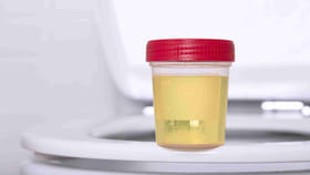 పురుషుల మూత్రం ఆ రంగులో ఉంటె... క్యాన్సర్ సంకేతమా? వాస్తవం ఏంటి.?