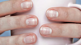 గోళ్లపై కనిపించే తెల్లని మచ్చలు భవిష్యత్తును సూచిస్తాయా.?