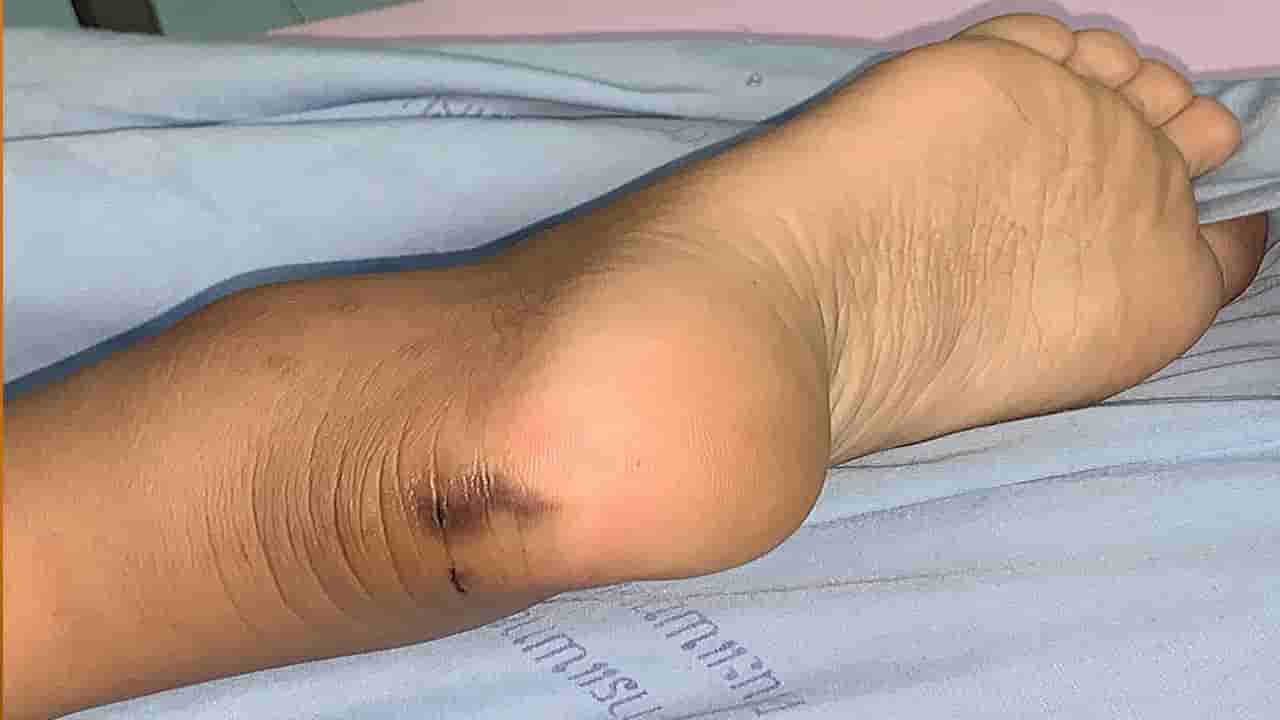 పాము కాటుతో చనిపోయిన మహిళ.. మూడేళ్ళ తర్వాత బయటపడ్డ నిజం..!