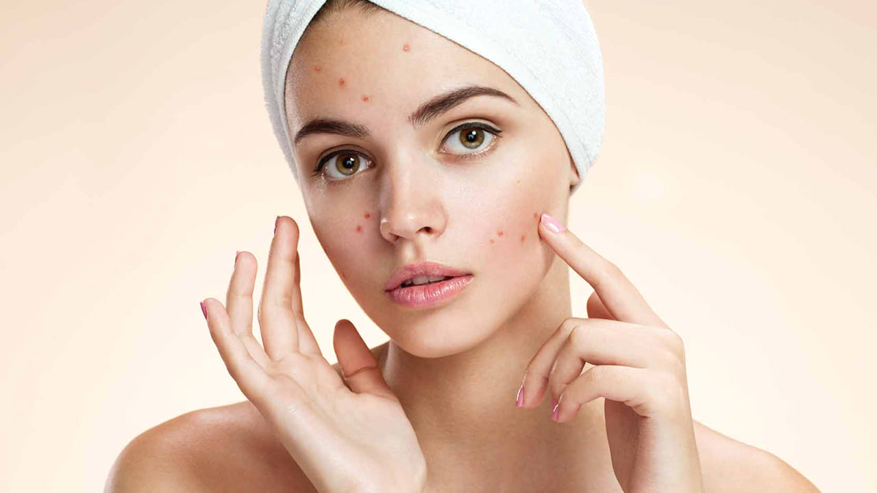 సకాలంలో ఈ తప్పును నివారించకపోతే సమస్య మరింత తీవ్రమవుతుంది. ముఖంపై మొటిమలు వచ్చే అవకాశం కూడా ఉంది. కాబట్టి ఈ రెండింటిని ఉపయోగించేటప్పుడు తగిన జాగ్రత్తగా ఉండాలని నిపుణులు సూచిస్తున్నారు.