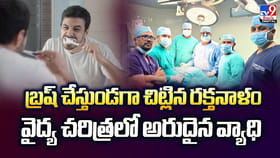 బ్రష్​ చేస్తుండగా చిట్లిన రక్తనాళం.. వైద్య చరిత్రలో అరుదైన వ్యాధి
