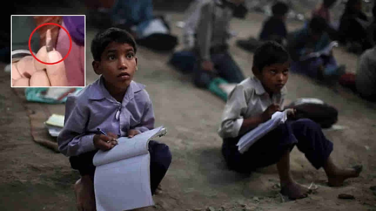 కాలిపై పుట్టిన కురుపు పగిలి బయటకు వచ్చిన బుల్లెట్.. యువతి పరేషాన్!