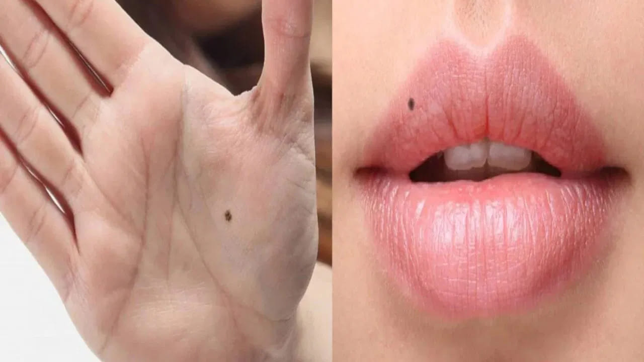 శరీరంపై పుట్టుమచ్చలు ఎందుకు కనిపిస్తాయి.. వాటి వెనుక ఉన్న అసలు రహస్యం ఏంటంటే..?