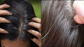 చిన్న వయసులోనే తెల్ల జుట్టు ఎందుకొస్తుంది.. అసలు నిజాలు తెలిస్తే