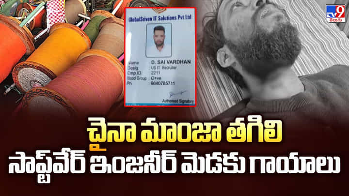 Hyderabad : చైనా మాంజా తగిలి సాప్ట్వేర్ ఇంజనీర్ మెడకు గాయాలు Hyderabad : చైనా మాంజా తగిలి సాప్ట్వేర్ ఇంజనీర్ మెడకు గాయాలు