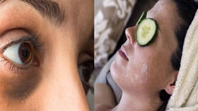 Health tips: కళ్ల కింద నల్లటి వలయాలు.. ఈ విషయాలు తెలుసుకోండి