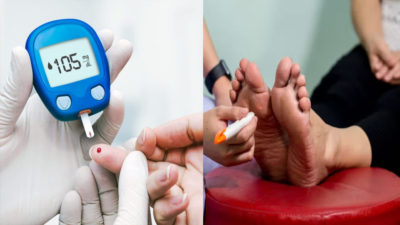 Diabetes Effects: అరికాళ్ళపై షుగర్ దాడి.. ఉస్మానియాలో ప్రత్యేక చికిత్స