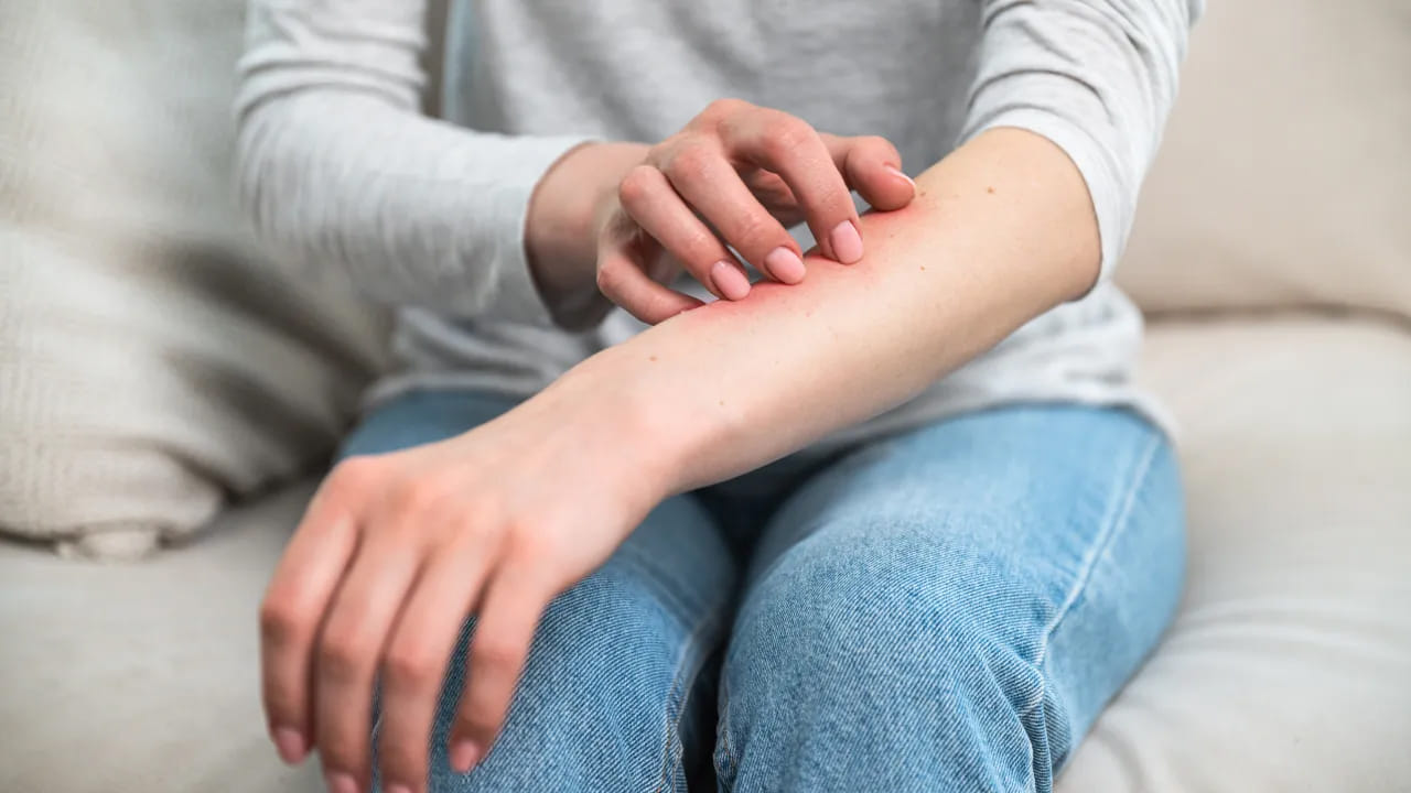 చర్మంపై కనిపించే ఈ మార్పులు విస్మరించొద్దు.. ఆ దీర్ఘకాలిక వ్యాధికి‌ సంకేతాలు కావొచ్చు!