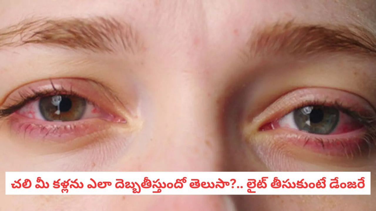Winter Eye Care: చలికాలంలో కళ్లను రుద్దుతున్నారా? అయితే మీరు ప్రమాదంలో ఉన్నట్లే!