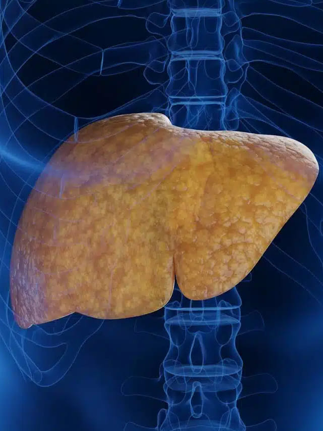 ఫ్యాటీ లివర్ డైట్.. కాలేయ ఆరోగ్యానికి అద్భుతమైన ఆహారాలు ఇవే!