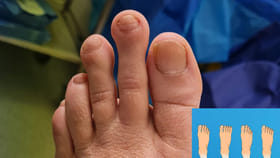 కాలు వేళ్లు పొడవుగా ఉన్నాయా..? వీరంతా అదృష్టవంతులే..!