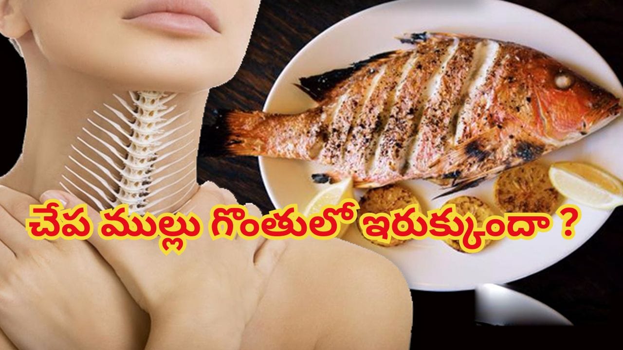 Fish Thorn: చేప ముల్లు గొంతులో ఇరుక్కుపోయిందా? వెంటనే ఇలా చేయండి.! ఇట్టే పోతుంది..