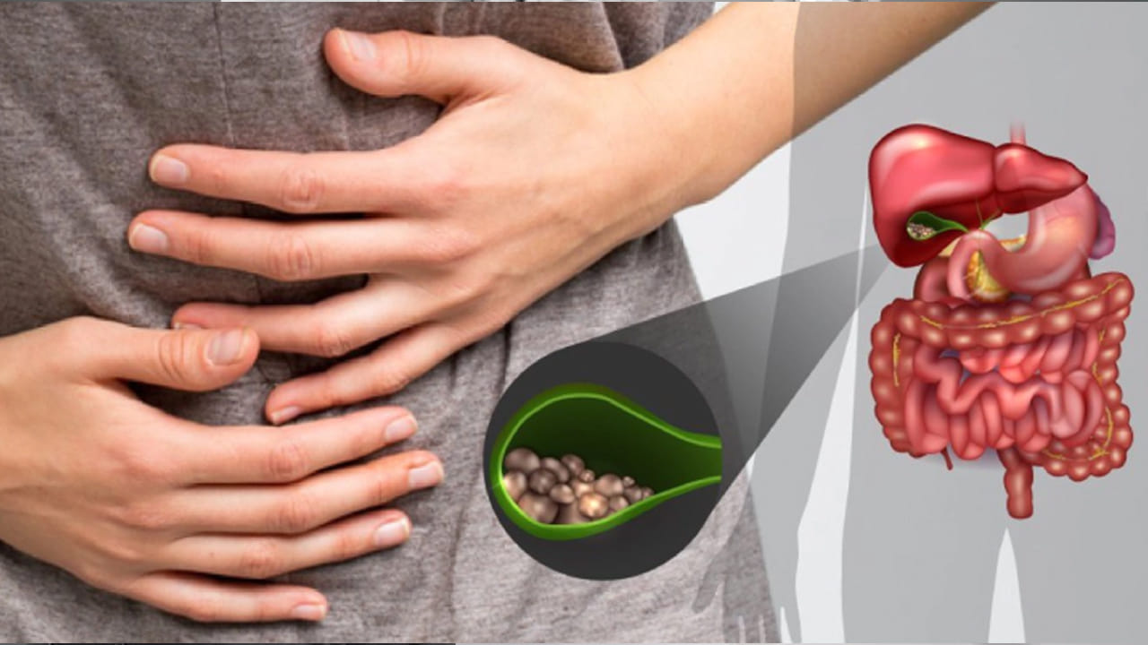 గాల్ బ్లాడర్ స్టోన్స్ లక్షణాల్లోకి వెళ్లితే..  గాల్ బ్లాడర్‌లో స్టోన్స్ ఉన్నప్పుడు కుడివైపు పై భాగంలో తీవ్ర మైన నొప్పి, వాంతులు , వికారం, విరేచనాలు, కడుపు ఉబ్బరం, పసుపు రంగులోకి కళ్లు మారడం, వెన్ను నొప్పి , జ్వరం వంటి లక్షణాలు కనిపిస్తాయంట.