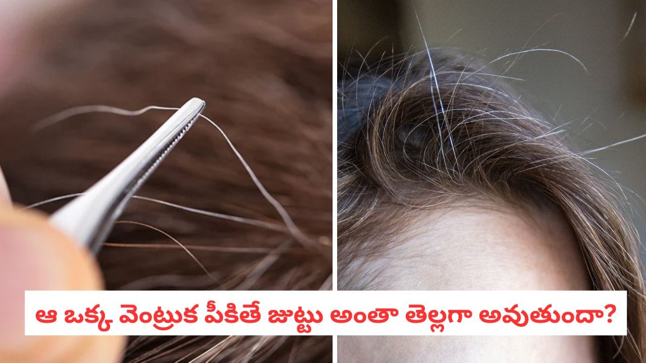 Grey Hair: తెల్ల వెంట్రుకను పీకితే మరిన్ని మొలుస్తాయా? మీ భయం వెనకున్న అసలు నిజం ఇదే!