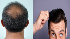 మీ జట్టు ఒత్తుగా పెరగాలంటే.. ఈ అద్భుత హెయిర్ ప్యాక్ అప్లై చేయండి