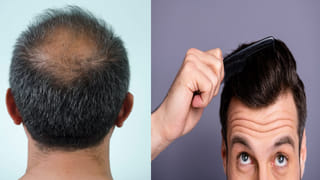 ఊరగాయ ప్రియులారా! ఈ విషయం మీకు తెలుసా..? ఆరోగ్య నిపుణుల సూచన ఏంటంటే..