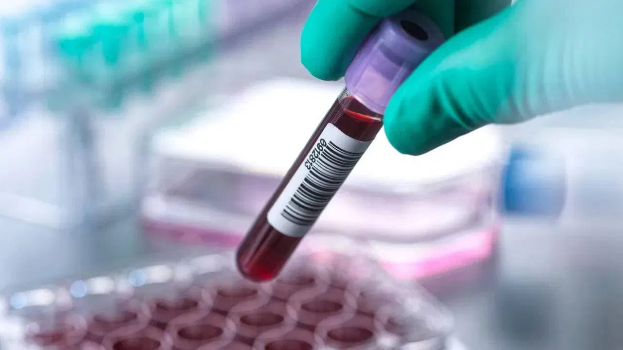 ఇది ఆరోగ్యంపై చెడు, ప్రతికూల ప్రభావాలను చూపుతుంది. మీరూ ఇలాంటి తప్పు చేస్తుంటే ఈరోజే జాగ్రత్తగా ఉండండి. వంట చేసేటప్పుడు ఆరోగ్యానికి మంచిది కదాని పసుపు కాస్త ఎక్కువగా వేస్తుంటారు. నిజానికి ఇది శరీరంలో ఇనుము శోషణను తగ్గిస్తుంది. రక్తహీనత లేదా హిమోగ్లోబిన్ స్థాయిలు ఇప్పటికే తక్కువగా ఉన్నవారు ప్రతిరోజూ పసుపు పాలు తాగడం హానికరం.