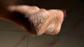 పాదాల పగుళ్లను చిటికెలో నయం చేసే ఇంటి చిట్కాలివో..