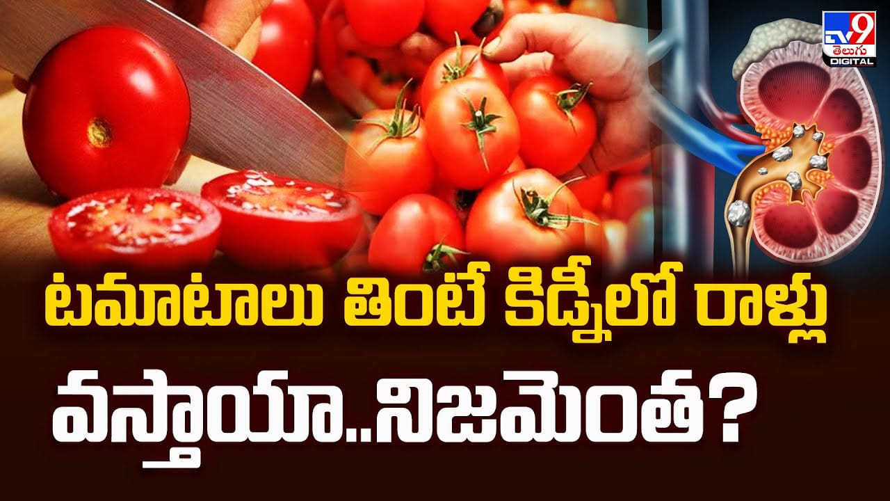టమాటాలు తింటే కిడ్నీలో రాళ్లు వస్తాయా.. నిజమెంత ?? టమాటాలు తింటే కిడ్నీలో రాళ్లు వస్తాయా.. నిజమెంత ??