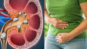 కిడ్నీలో రాళ్లు.. తీవ్రమైన సమస్యకు ఈ 3 సింపుల్ టిప్స్‌తో చెక్..