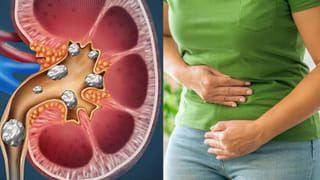 Chicken skin omelette: కోడి తోలు ఆమ్లెట్ ఇలా చేసుకుని తింటే.. జన్మలో మర్చిపోరు, ఇదిగో రెసిపీ