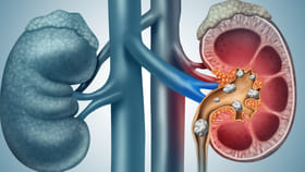 మూత్ర పిండాల్లో రాళ్లు ప్రమాదకరమా? శస్త్రచికిత్స ఎప్పుడు అవసరమంటే