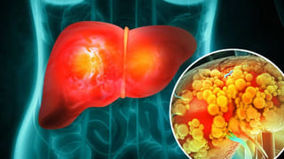 Vegetarian Food: శాఖాహారం అధికంగా తీసుకునే దేశం ఏదో తెలుసా?