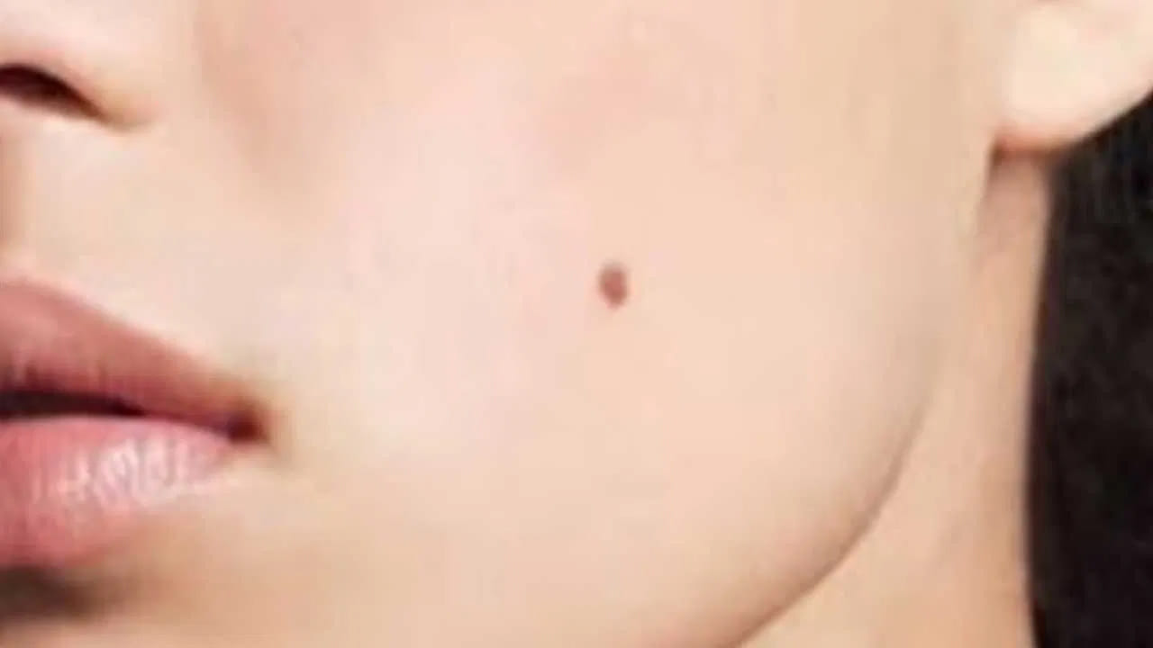  అదే విధంగా స్త్రీలకు చెంపపై పుట్టు మచ్చ ఉండటం చాలా  శుభప్రదం. ఈ రకమైన వారు చాలా అదృష్టవంతులు అవుతారంట. ముఖ్యంగా  ఎవరికి అయితే ఎడుమ చెంప పై పుట్టు మచ్చ ఉంటుందో వారికి ఆర్థికంగా కలిసి వస్తుంది. అలాగే ఎవరికి అయితే కుడి చెంపపై పుట్టు మచ్చ ఉంటుందో వారికి పుత్రలాభం కలుగుతుంది. అంటే పుత్రులు జన్మించిడం వారి వలన ఆనందంగా జీవించడం జరుగుతుంది.