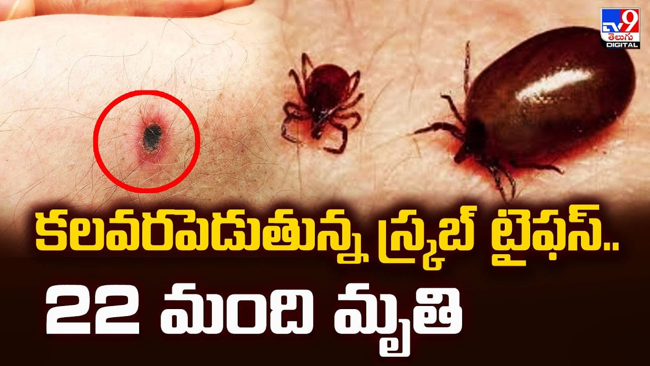 కలవరపెడుతున్న స్క్రబ్‌ టైఫస్‌..22 మంది మృతి
