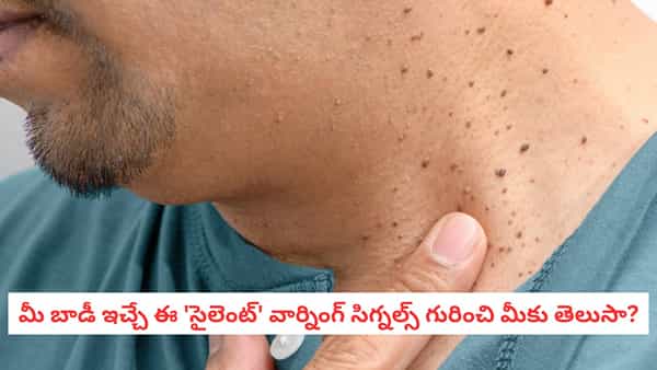 Skin Tags: మెడ, చంకల్లో వచ్చే ఇవి కనపడితే నిర్లక్ష్యం చేయకండి.. సైలెంట్ కిల్లర్ సంకేతాలు కావచ్చు!