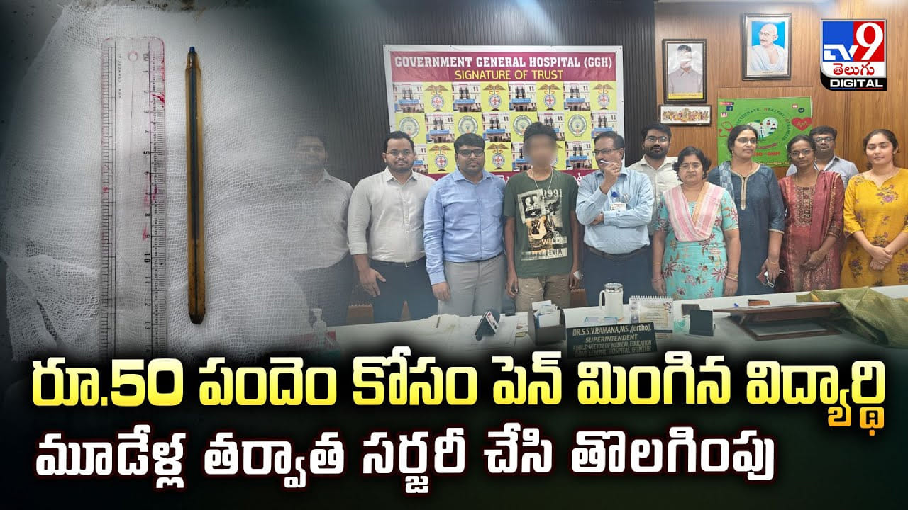 రూ.50 పందెం కోసం పెన్ మింగిన విద్యార్థి.. మూడేళ్ల తర్వాత సర్జరీ చేసి తొలగింపు