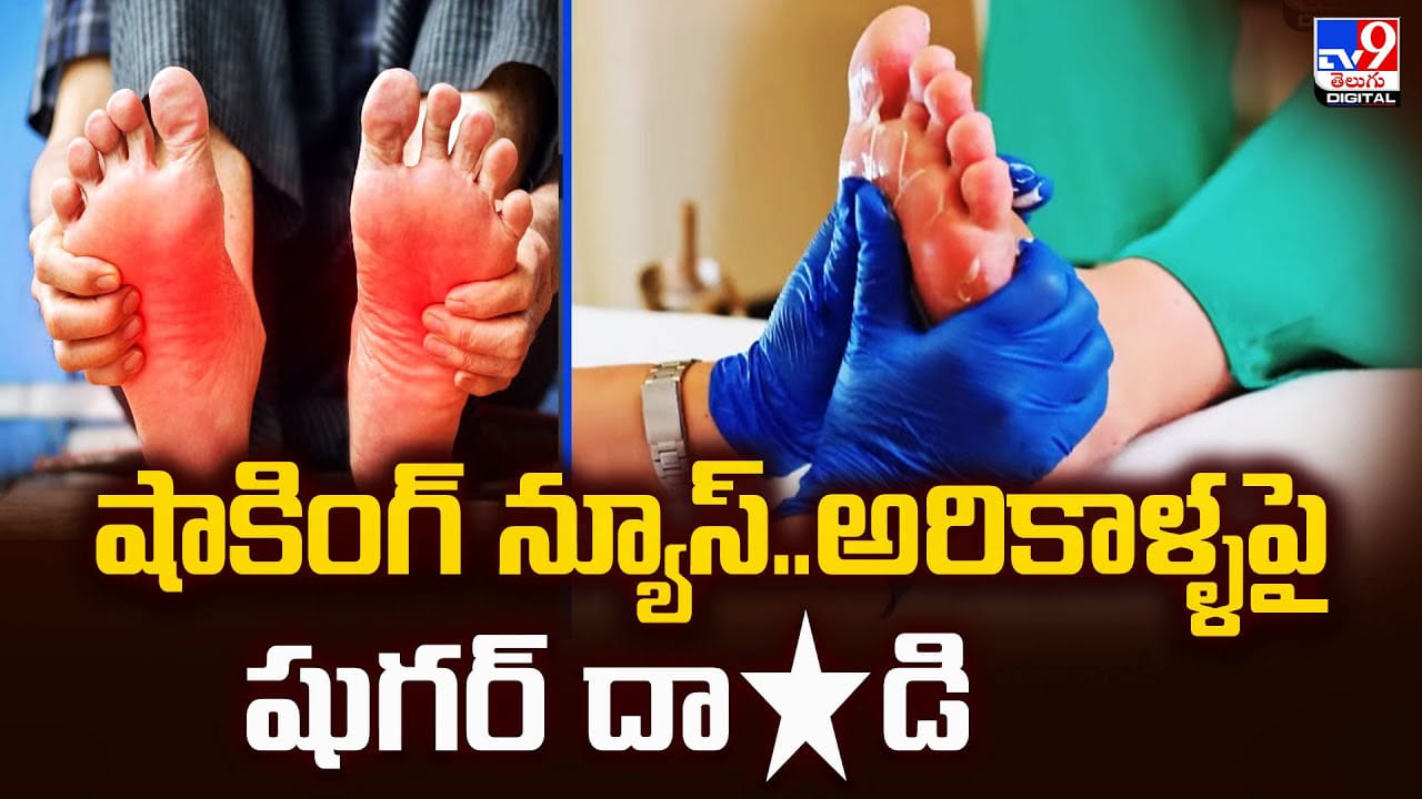 షాకింగ్‌ న్యూస్‌.. అరికాళ్ళపై షుగర్ దాడి