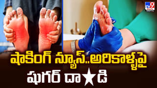 మీరూ వేడి నీటితో తల స్నానం చేస్తున్నారా? ఎంత డేంజరో తెలుసా..