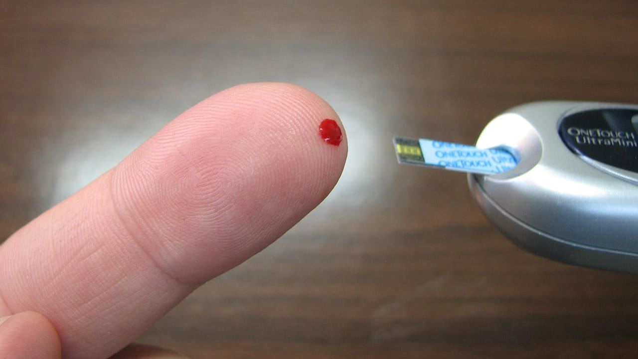 జీవితంలో ఒకసారి షుగర్ వ్యాధి వస్తే ..తెలియని ఒక భయం స్టార్ట్ అవుతుంది. ఒకప్పుడు పెద్ద వాళ్లకు మాత్రమే ఉండేది. కానీ, ఇప్పుడు 25 ఏళ్ళు లోపు ఉన్న వారు కూడా ఈ సమస్యతో బాధ పడుతున్నారు. దీనికి కారణం మనం తీసుకునే ఫుడ్స్. ఇక్కడ కంట్రోల్ చేసుకుంటే అన్ని కంట్రోల్ అవుతాయి. 