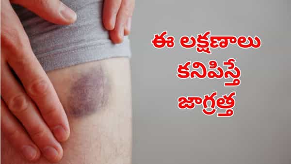 Health Tips: మీలో ఈ లక్షణాలు కనిపిస్తే.. అస్సలు లైట్ తీసుకోవద్దు.. డేంజర్ సమస్యలకు కారణం కావచ్చు