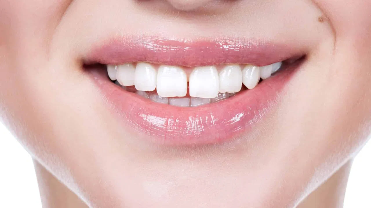 Oral Health: దంతాలు మీ జీవితాన్ని తలకిందులు చేయగలవు..! న్యూస్టడీ షాకింగ్ రిపోర్ట్