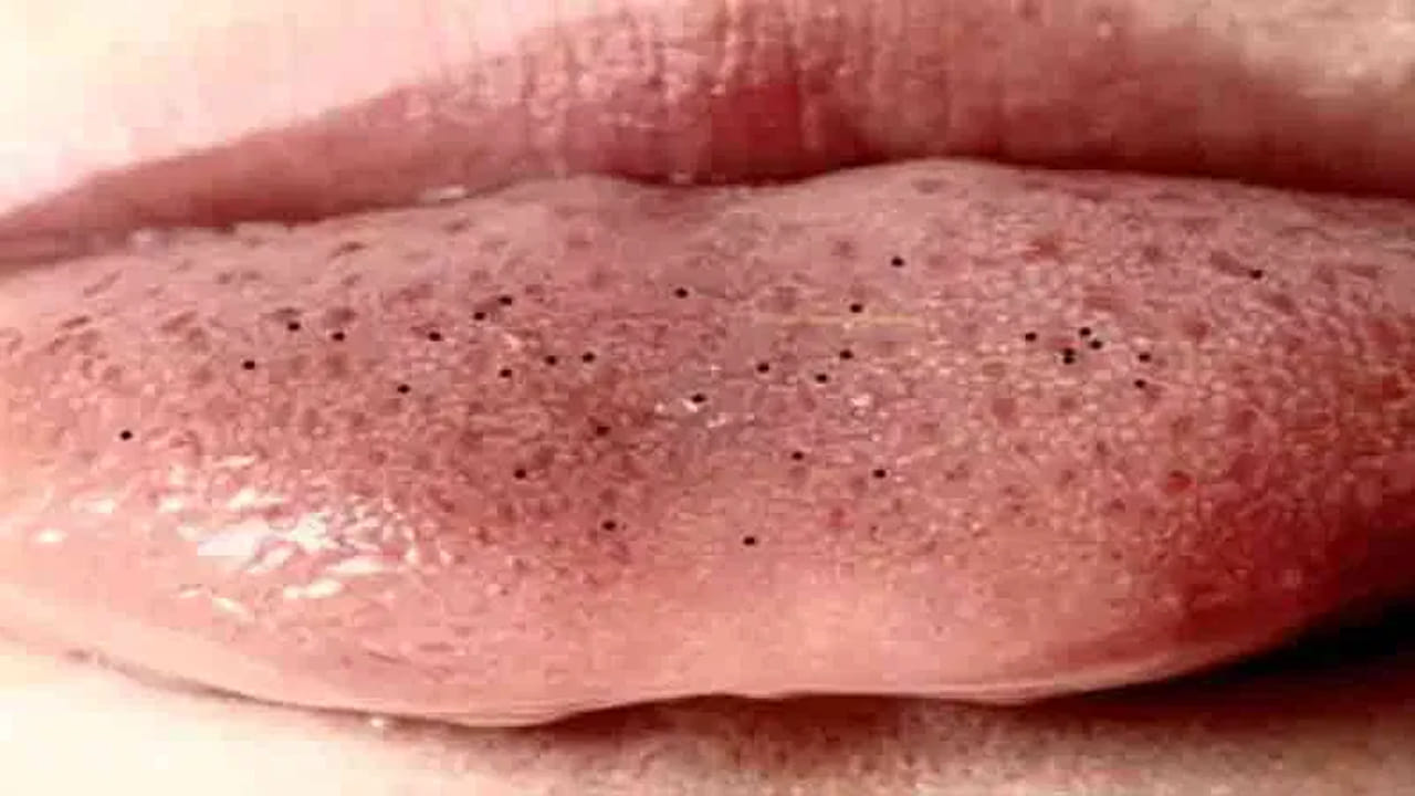 అయితే సాముద్రిక శాస్త్రం ప్రకారం, ఈ నాలుకపై మచ్చలు కూడా రెండు రకాలుగా ఉంటాయంట. నాలుక దిగువ భాగంలో, నాలుక ఎగువ భాగంలో మచ్చలు ఉంటాయి. అయితే ఎవరికి అయితే నాలుక దిగువ భాగంలో మచ్చలు ఉంటాయో, వారు భోజన ప్రియులంట. అంతే కాకుండా మంచి కళానైపుణ్యం కలిగి ఉంటారని చెబుతున్నారు పండితులు.